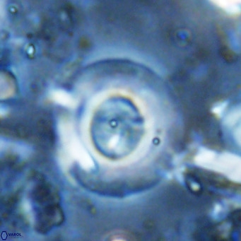 Reticulofenestra primitiva VR 03042