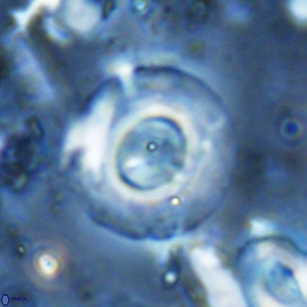Reticulofenestra primitiva VR 03043