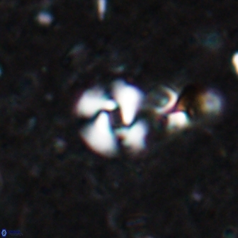 Reticulofenestra pseudogammation 19461