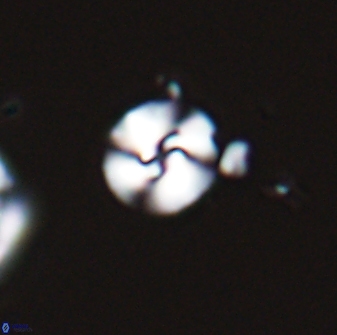 Reticulofenestra pseudogammation 25998