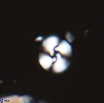 Reticulofenestra sp. A 25999