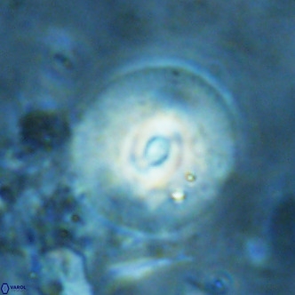 Reticulofenestra pseudogammation VR 02746