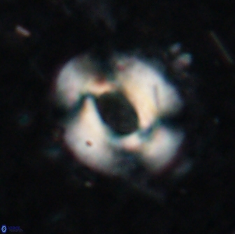 Reticulofenestra pseudoumbilicus 19417