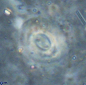 Reticulofenestra pseudoumbilicus 19414