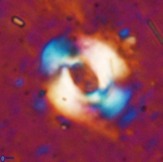 Reticulofenestra pseudoumbilicus 19418