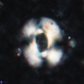 Reticulofenestra pseudoumbilicus 19420