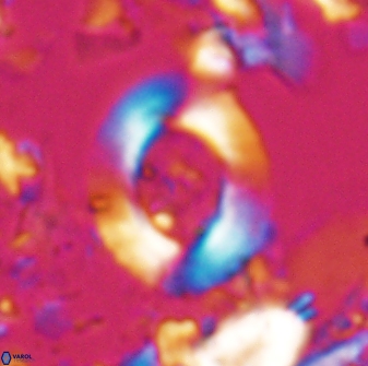 Reticulofenestra pseudoumbilicus amplus 22754