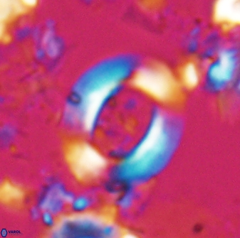 Reticulofenestra pseudoumbilicus amplus 22755