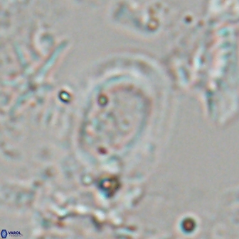 Reticulofenestra pseudoumbilicus amplus 22757