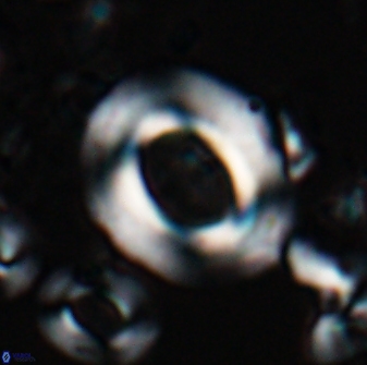 Reticulofenestra pseudoumbilicus amplus 26406