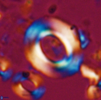 Reticulofenestra pseudoumbilicus amplus 26407