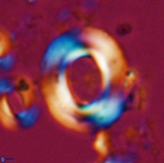 Reticulofenestra pseudoumbilicus amplus 26408