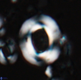 Reticulofenestra pseudoumbilicus amplus 26409