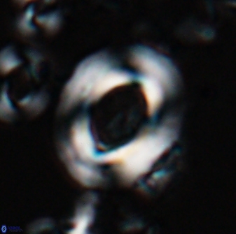 Reticulofenestra pseudoumbilicus amplus 26410