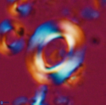 Reticulofenestra pseudoumbilicus amplus 26411