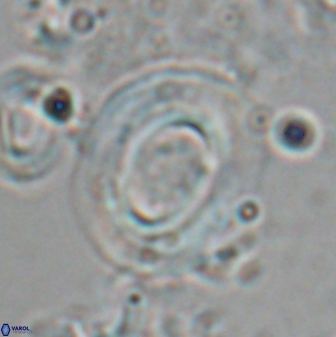 Reticulofenestra pseudoumbilicus amplus 26412