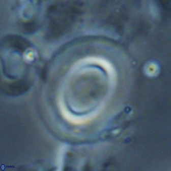 Reticulofenestra pseudoumbilicus amplus 26413