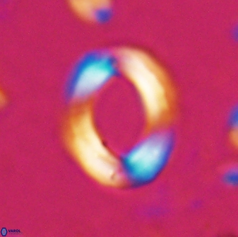 Reticulofenestra pseudoumbilicus amplus 26553