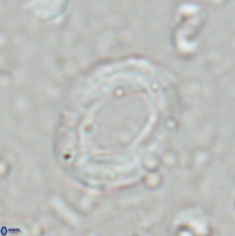 Reticulofenestra pseudoumbilicus amplus 26557