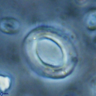 Reticulofenestra pseudoumbilicus amplus 26560