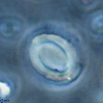 Reticulofenestra pseudoumbilicus amplus 26561