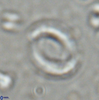 Reticulofenestra pseudoumbilicus amplus 26562