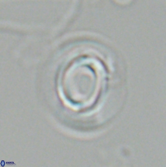 Reticulofenestra pseudoumbilica 27524