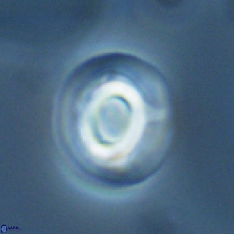 Reticulofenestra pseudoumbilica 27525