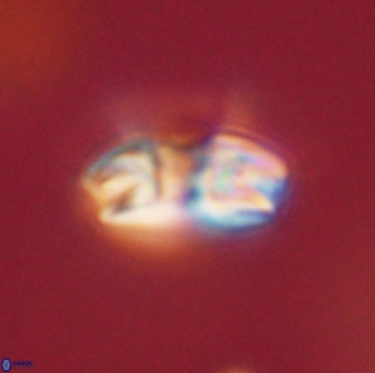 Reticulofenestra pseudoumbilica 47185