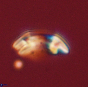 Reticulofenestra pseudoumbilica 47193