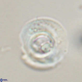 Reticulofenestra rupeliensis VR 30994