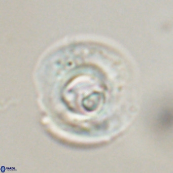 Reticulofenestra rupeliensis VR 30996