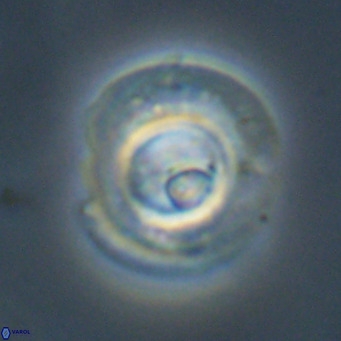 Reticulofenestra rupeliensis VR 30997