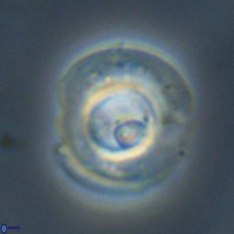 Reticulofenestra rupeliensis VR 30998