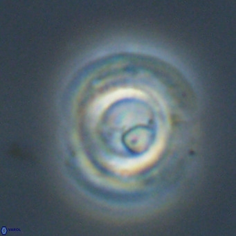 Reticulofenestra rupeliensis VR 30999