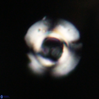 Reticulofenestra rupeliensis VR 30992