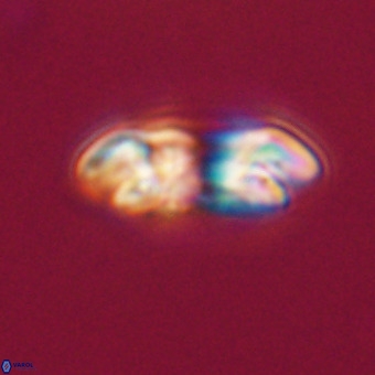 Reticulofenestra rupeliensis VR 31004