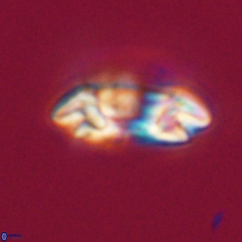 Reticulofenestra rupeliensis VR 31008