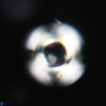Reticulofenestra rupeliensis VR 31001