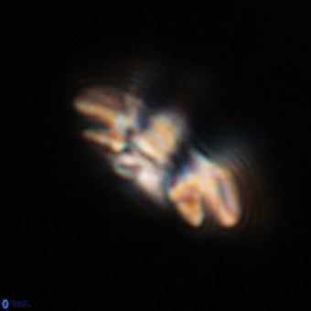 Reticulofenestra rupeliensis VR 31010