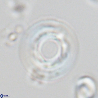 Reticulofenestra rupeliensis 27471