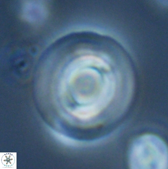 Reticulofenestra rupeliensis 27472