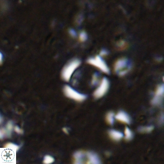 Reticulofenestra rotaria 48892