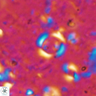Reticulofenestra rotaria 48893