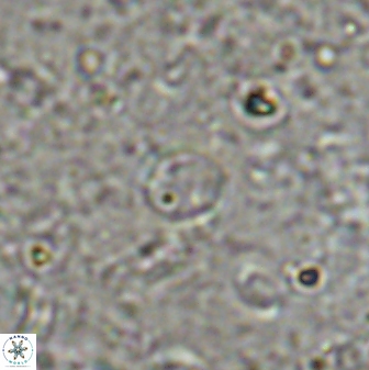 Reticulofenestra rotaria 48894