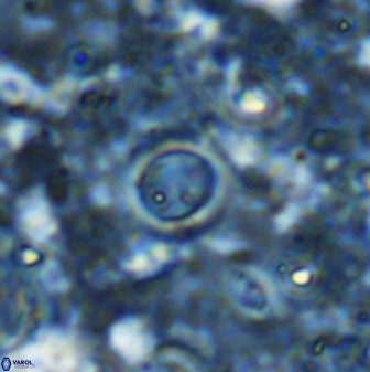 Reticulofenestra rotaria 48895