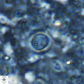Reticulofenestra rotaria 48895