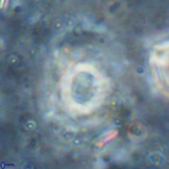 Reticulofenestra subrotunda 19430