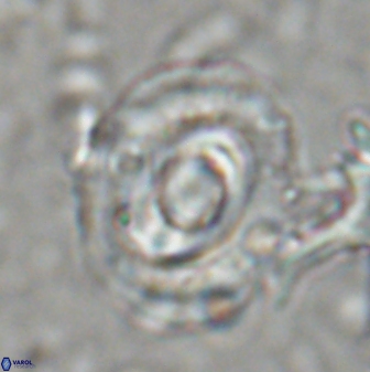 Reticulofenestra subrotunda 27079
