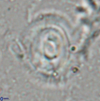 Reticulofenestra subrotunda 27080